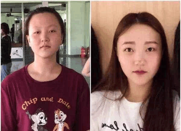 秋季怎么调理脾胃好秋季调理脾胃的误区:LOL英雄联盟投注 - 官方电竞竞猜平台官网(图1) LOL英雄联盟投注 - 官方电竞竞猜平台官网