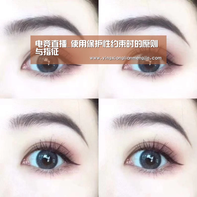电竞直播_使用保护性约束时的原则与指征(图2) LOL英雄联盟投注 - 官方电竞竞猜平台