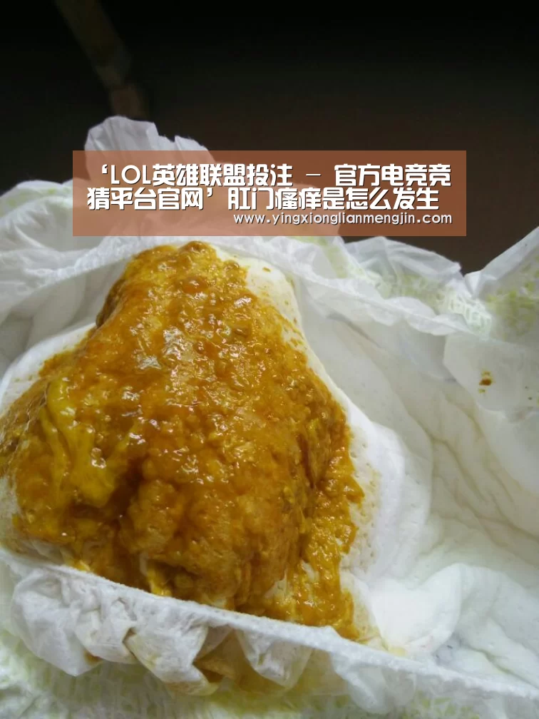 电竞赛事